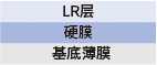 LR 結構